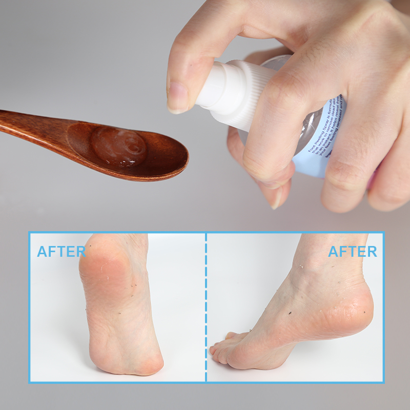 Softening Instant Exfoliating Dead Skin Foot Care Spray Anti Cracking Foot Masking Moisturizing - 2